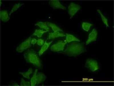Immunocytochemistry/ Immunofluorescence: ANKRA2 Antibody (1D11) [H00057763-M01]