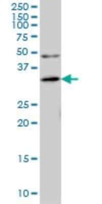 Western Blot: ANKRA2 Antibody (1D11) [H00057763-M01]