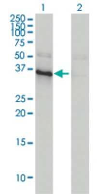 Western Blot: ANKRA2 Antibody (1D11) [H00057763-M01]