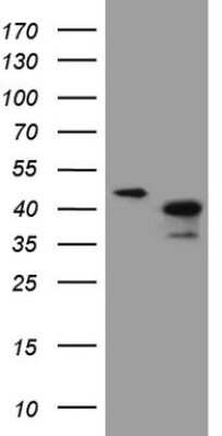 Western Blot: ANKRA2 Antibody (OTI8A9) [NBP2-46525]