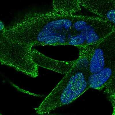 Immunocytochemistry/ Immunofluorescence: ANKRA2 Antibody [NBP2-57230]