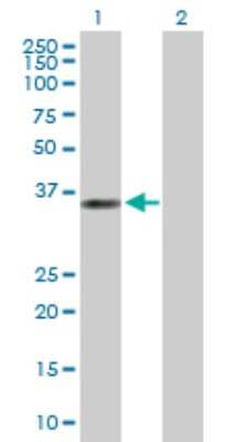 Western Blot: ANKRA2 Antibody [H00057763-B01P]