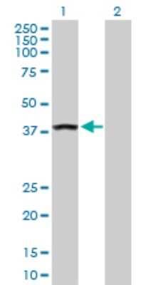 Western Blot: ANKRA2 Antibody [H00057763-D01P]