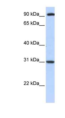 Western Blot: ANKRA2 Antibody [NBP1-79395]