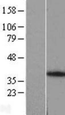 Western Blot: ANKRA2 Overexpression Lysate [NBL1-07532]