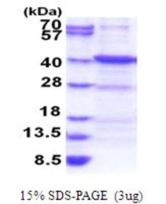 SDS-PAGE: Recombinant Human ANKRA2 His Protein [NBP2-51799]