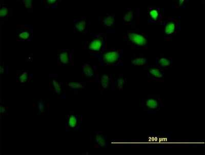 Immunocytochemistry/ Immunofluorescence: ANKRD1 Antibody [H00027063-B02P]