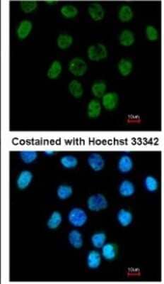 Immunocytochemistry/ Immunofluorescence: ANKRD1 Antibody [NBP2-15397]
