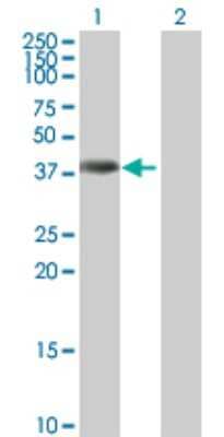 Western Blot: ANKRD1 Antibody [H00027063-B01P]