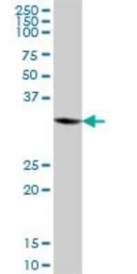 Western Blot: ANKRD1 Antibody [H00027063-B02P]