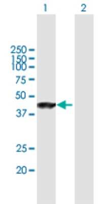 Western Blot: ANKRD1 Antibody [H00027063-B02P]