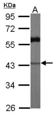 Western Blot: ANKRD1 Antibody [NBP2-15397]