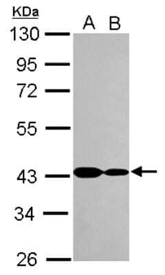 Western Blot: ANKRD1 Antibody [NBP2-15397]
