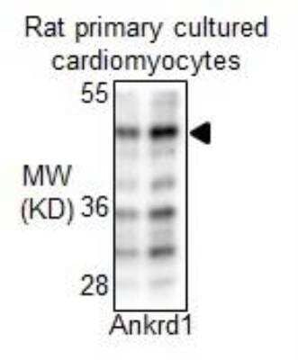 Western Blot: ANKRD1 Antibody [NBP2-15397]