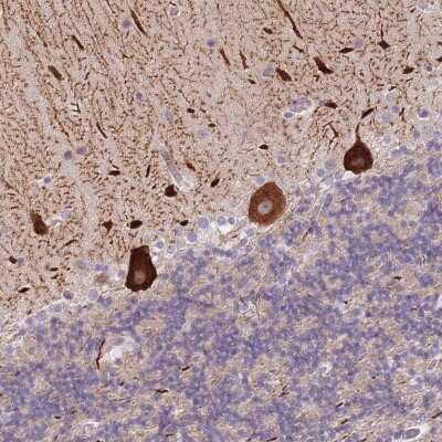 Immunohistochemistry: ANKRD10 Antibody [NBP2-37890]