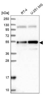 Western Blot: ANKRD10 Antibody [NBP2-37891]