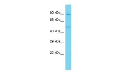 Western Blot: ANKRD10 Antibody [NBP2-84427]