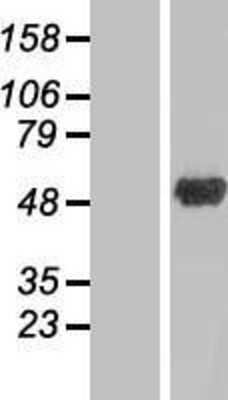 Western Blot: ANKRD10 Overexpression Lysate [NBP2-06954]