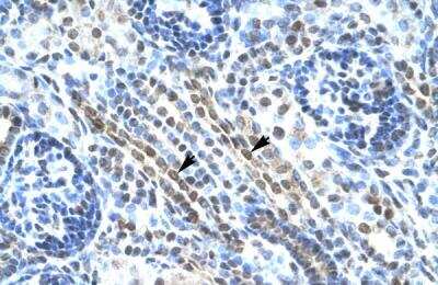 Immunohistochemistry-Paraffin: ANKRD11 Antibody [NBP1-52984]