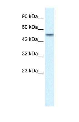 Western Blot: ANKRD11 Antibody [NBP1-52984]