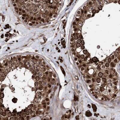 Immunohistochemistry-Paraffin: ANKRD12 Antibody [NBP1-93990]