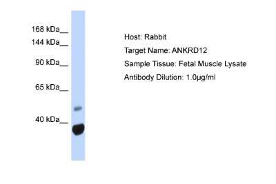 Western Blot: ANKRD12 Antibody [NBP2-82601]