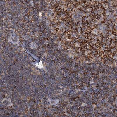 Immunohistochemistry-Paraffin: ANKRD13A Antibody [NBP1-89082]