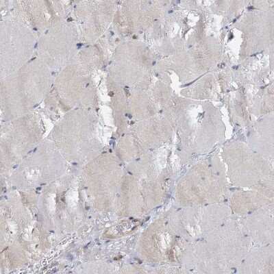 Immunohistochemistry-Paraffin: ANKRD13A Antibody [NBP1-89082]