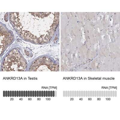 Immunohistochemistry-Paraffin: ANKRD13A Antibody [NBP1-89082]