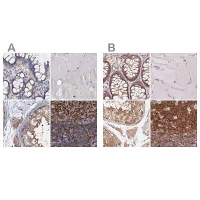 Immunohistochemistry-Paraffin: ANKRD13A Antibody [NBP1-89082]