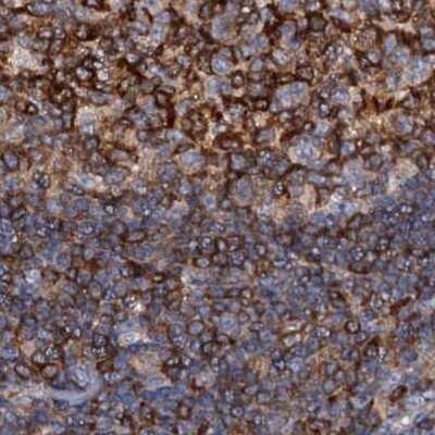 Immunohistochemistry-Paraffin: ANKRD13A Antibody [NBP1-89082]