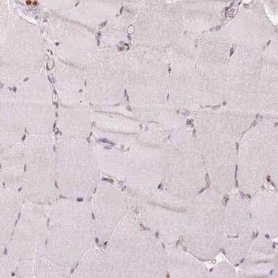 Immunohistochemistry-Paraffin: ANKRD13A Antibody [NBP2-38505]