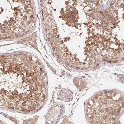 Immunohistochemistry-Paraffin: ANKRD13A Antibody [NBP2-38505]