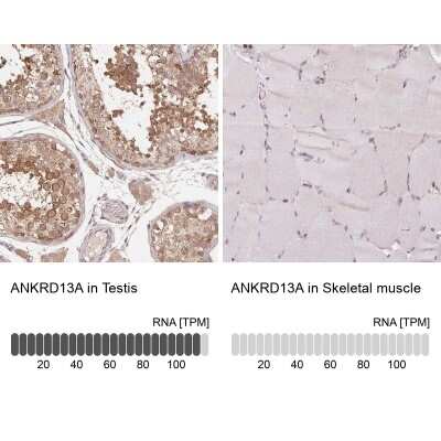 Immunohistochemistry-Paraffin: ANKRD13A Antibody [NBP2-38505]