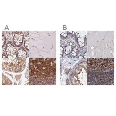 Immunohistochemistry-Paraffin: ANKRD13A Antibody [NBP2-38505]