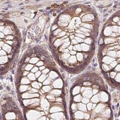 Immunohistochemistry-Paraffin: ANKRD13A Antibody [NBP2-38505]