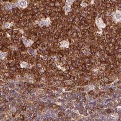 Immunohistochemistry-Paraffin: ANKRD13A Antibody [NBP2-38505]