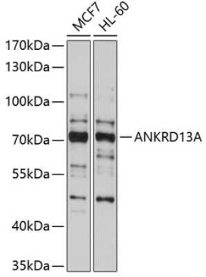 Western Blot: ANKRD13A AntibodyBSA Free [NBP2-92019]