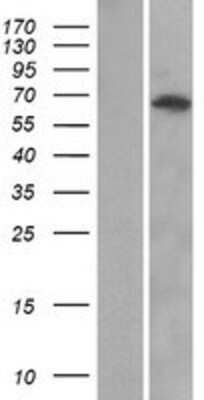 Western Blot: ANKRD13A Overexpression Lysate [NBP2-05918]