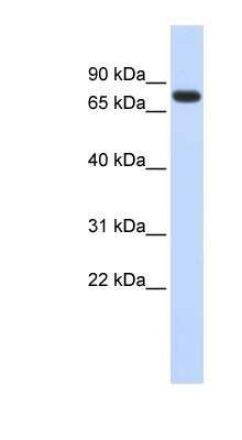 Western Blot: ANKRD13B Antibody [NBP1-91433]