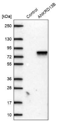 Western Blot: ANKRD13B Antibody [NBP2-14293]