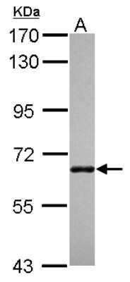 Western Blot: ANKRD13B Antibody [NBP2-15398]