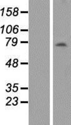 Western Blot: ANKRD13B Overexpression Lysate [NBP2-05389]