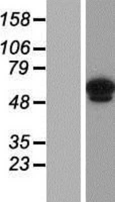 Western Blot: ANKRD13C Overexpression Lysate [NBP2-06177]