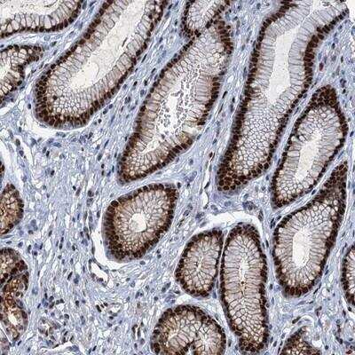 Immunohistochemistry: ANKRD13D Antibody [NBP1-86244]