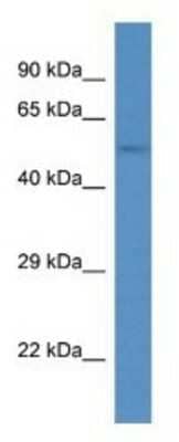 Western Blot: ANKRD13D Antibody [NBP1-79611]