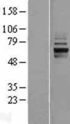 Western Blot: ANKRD13D Overexpression Lysate [NBP2-04493]