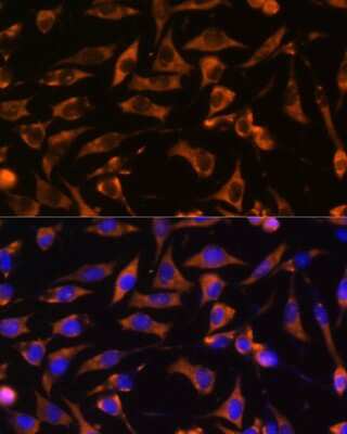 Immunocytochemistry/ Immunofluorescence: ANKRD15 Antibody - Azide and BSA Free [NBP2-92635]