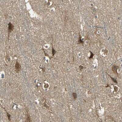 Immunohistochemistry-Paraffin: ANKRD15 Antibody [NBP1-90167]
