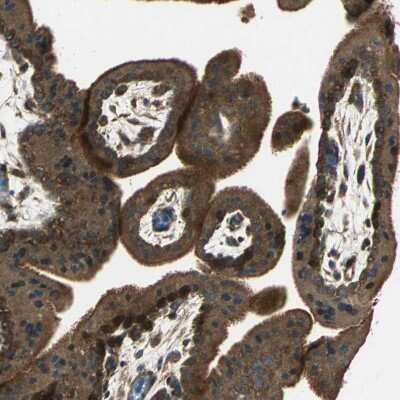Immunohistochemistry-Paraffin: ANKRD15 Antibody [NBP1-90167]
